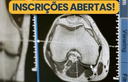 Diagnóstico por Imagem em Oncologia