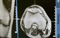 Diagnóstico por Imagem em Oncologia